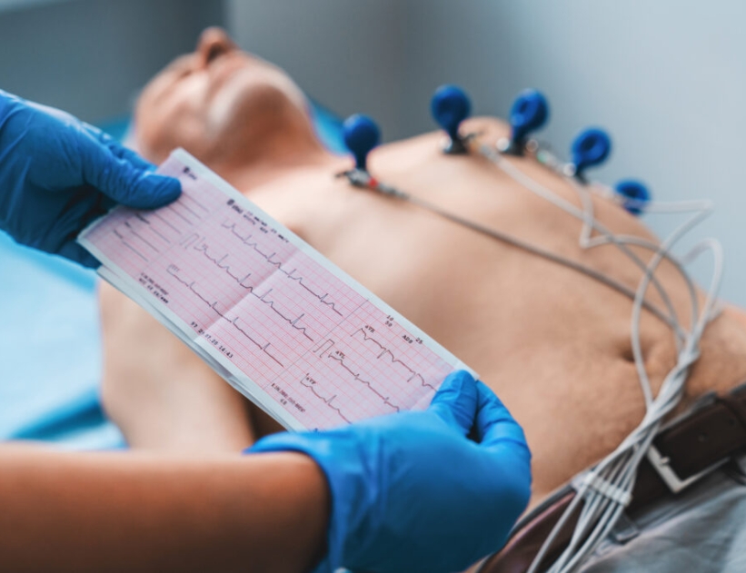 Electrocardiogram, ECG in hand. Cardiogram printout on male patient background